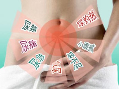 治疗女性尿道炎有哪些方法