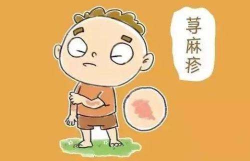 荨麻疹有哪些症状