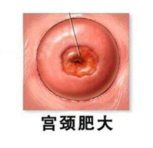 QQ截图20170626144425.jpg